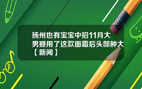 扬州也有宝宝中招11月大男婴用了这款面霜后头部肿大【新闻】